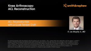 ACL-rekonstruktion med Quadricepssenegraft, Artroskopisk 1