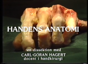 Handens Anatomi (Del 1, Senor, nerver och småmuskler)