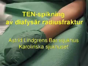 Diafysär Radiusfraktur, TEN-spikning (ALB)